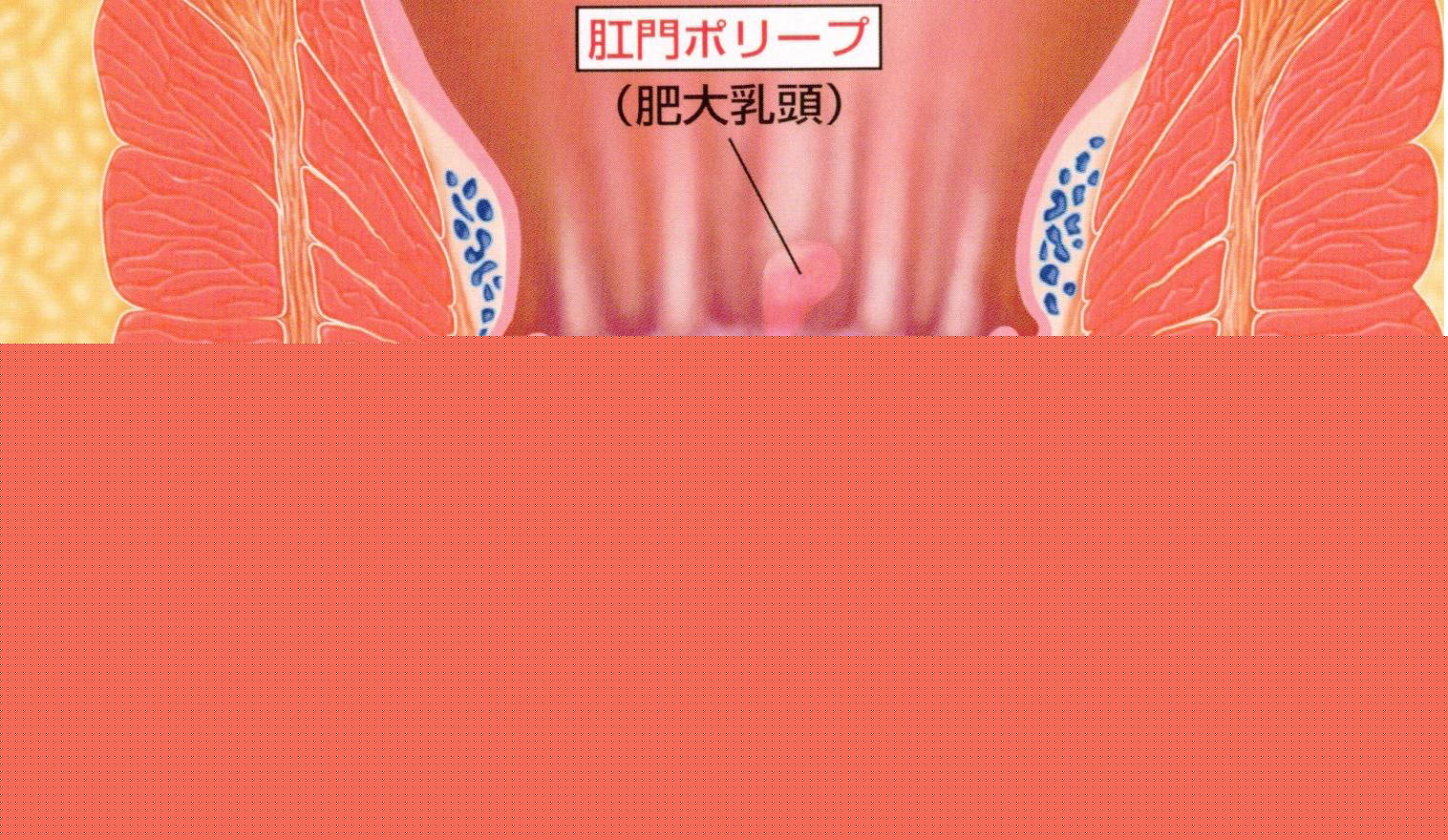 �؂ꎤ�̉��